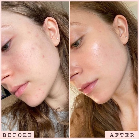 NEW - FRANK BODY brightning vitamin C mask - Picture 2 of 11